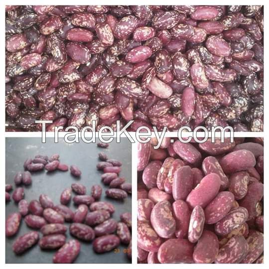 Light speckled kidney beans