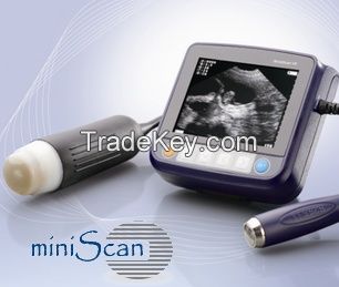 miniscan wrist ultrasound scanner