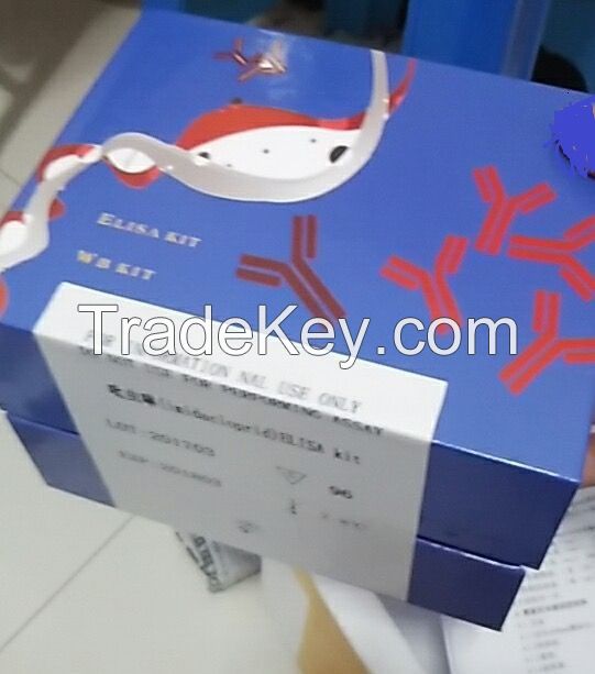 Fish Follicle-stimulating hormone(FSH) ELISA Kit