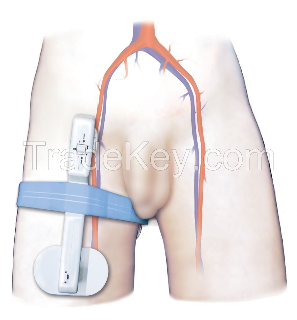 Electronic Femoral Hemostasis Compression Device