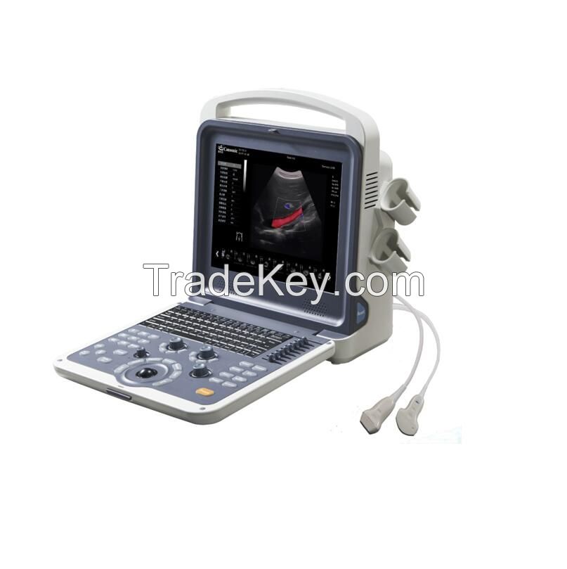 Full Digital 3D/4D Color Doppler Ultrasounds Scanner (YJ-U60PLUS)