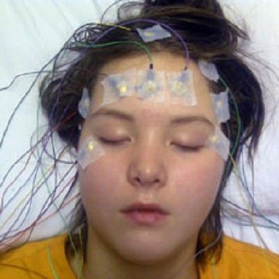 Reusable Silver EEG Cup Electrodes line