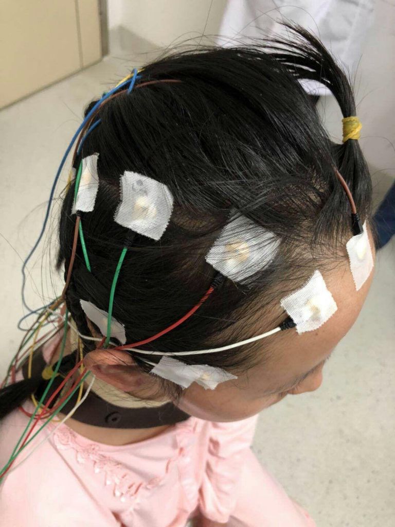 Reusable Plum blossom EEG Electrode line,EEG Electrode line