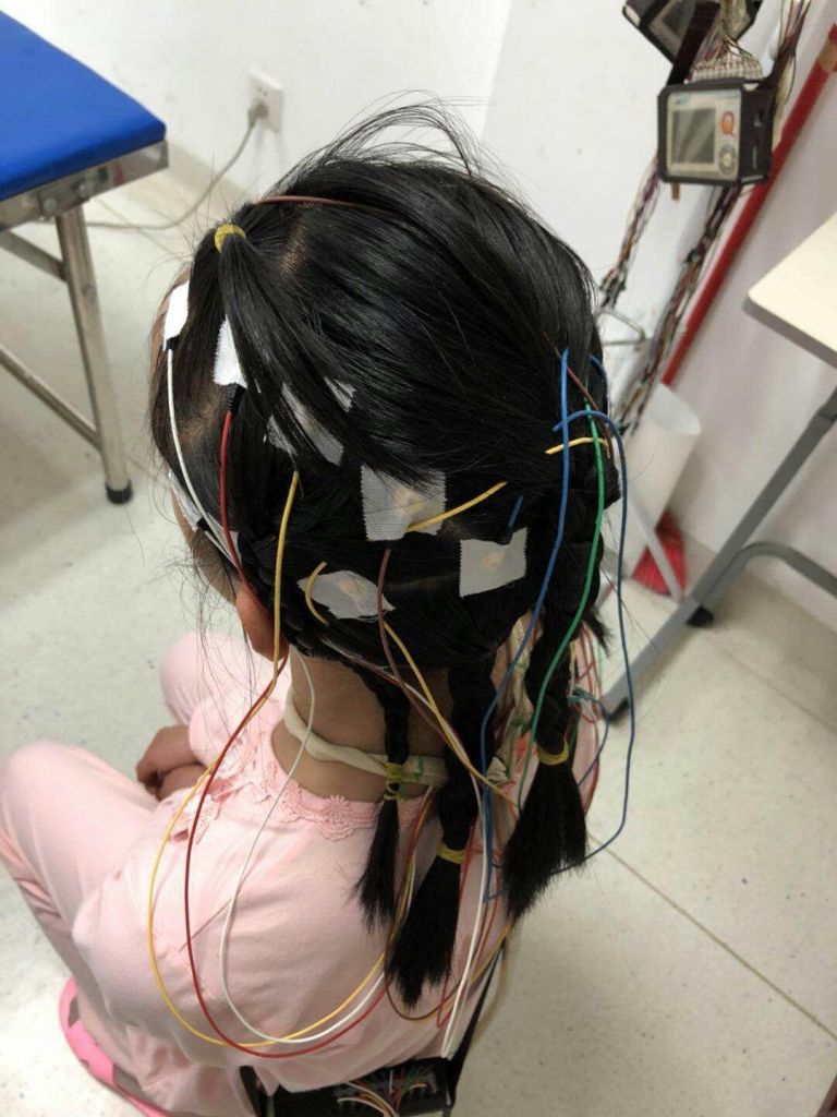 Reusable Plum blossom EEG Electrode line,EEG Electrode line