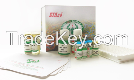 Human High mobility group protein B1 elisa kit