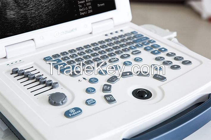DW-500 laptop ultrasonic dignostic ultrasound machine
