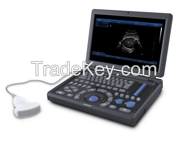 Canyearn A15 Full Digital Laptop Ultrasonic Diagnostic System Black and White Ultrasound Scanner