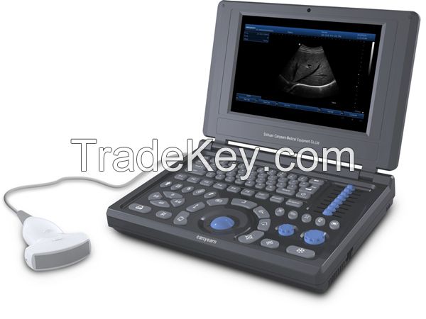 Canyearn A10 Full Digital Laptop Ultrasonic Diagnostic System Black and White Ultrasound Scanner