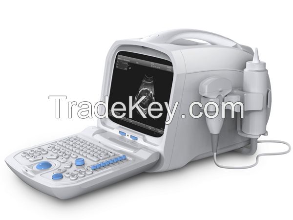 Canyearn A60 Full Digital Portable Ultrasonic Diagnostic System Black and White Ultrasound Scanner