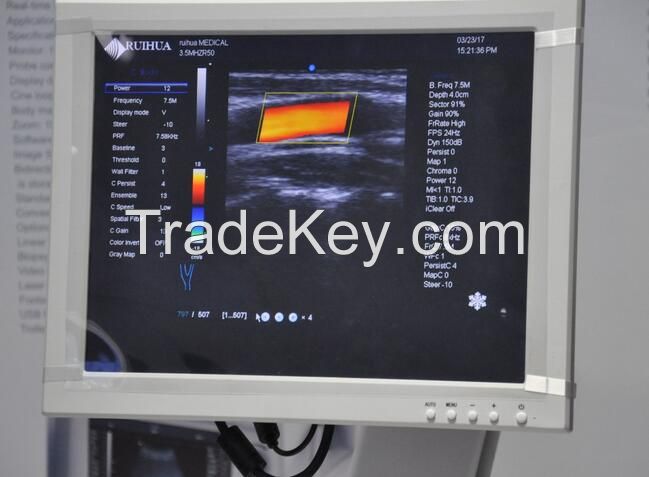 Canyearn C75 Full Digital Trolley Ultrasonic Diagnostic System Color Doppler Ultrasound Scanner