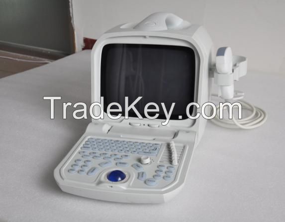 Canyearn A60 Full Digital Portable Ultrasonic Diagnostic System Black and White Ultrasound Scanner