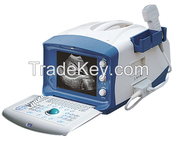 portable Ultrasound medical equipment gynaecologist health care advice home health care advice SPW-1B