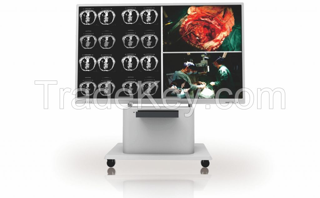 KTC Consultation Center Medical Display Monitor