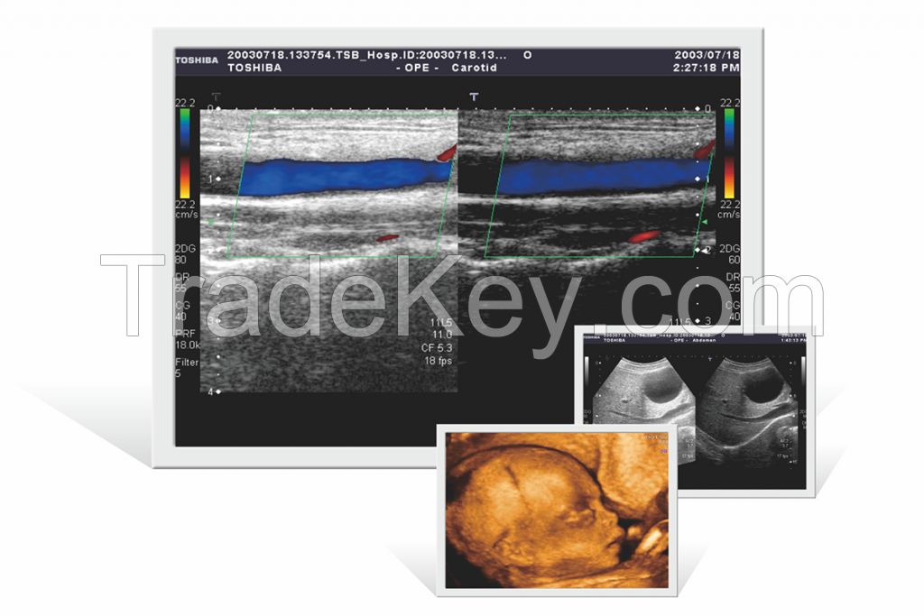 KTC Customized Ultrasound Medical Monitor