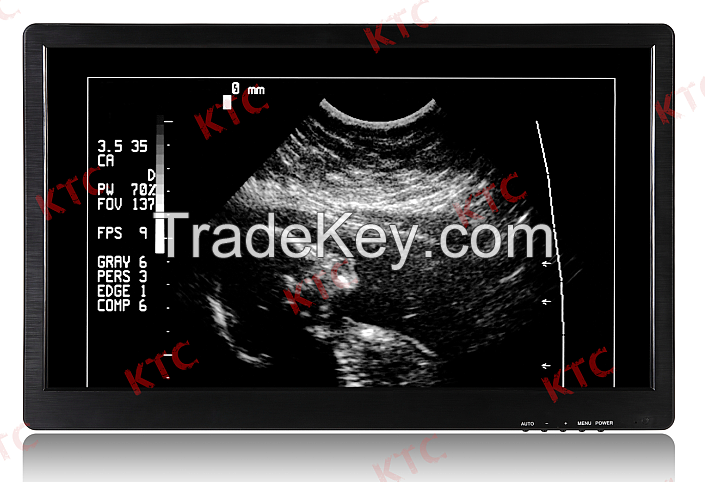 KTC Ultrasound medical grade monitor