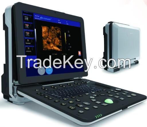 Laptop  Ultrasound Color Doppler scanner diagnostic machine 3D/ 4D model C300