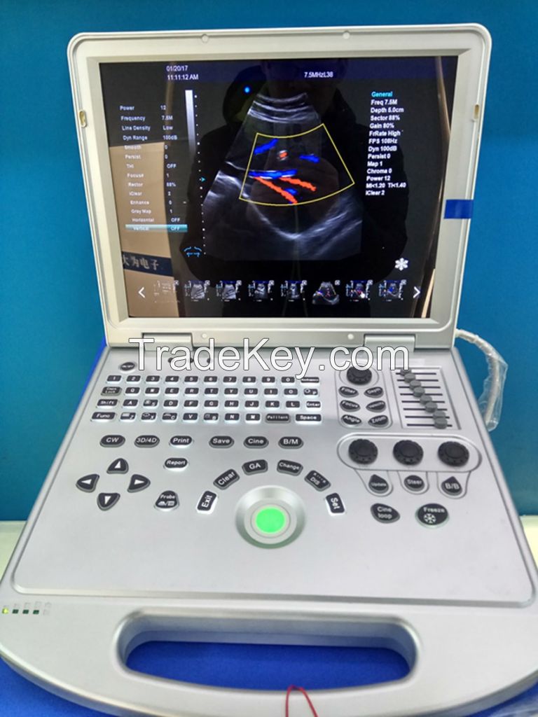 Laptop  Ultrasound Color Doppler scanner diagnostic machine 3D/ 4D model