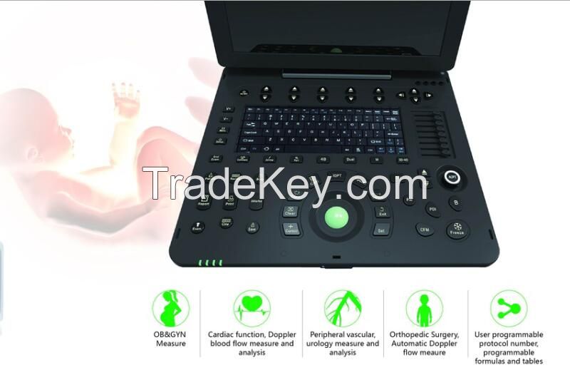 Laptop  Ultrasound Color Doppler scanner diagnostic machine 3D/ 4D model C300