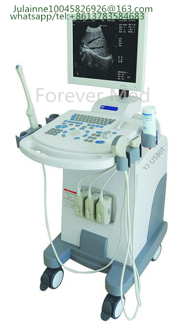 Hot Medical Supply Hospital Trolley Color Doppler Ultrasound Machines FDA(YJ-U370T)