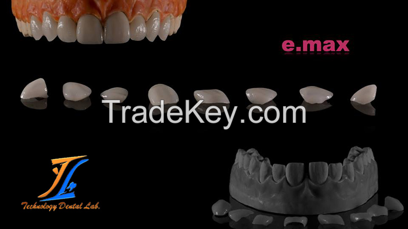 Dental emax  ceramic veneers dental supplies