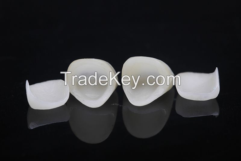 Dental High Quality ceramic veneers dental supplies