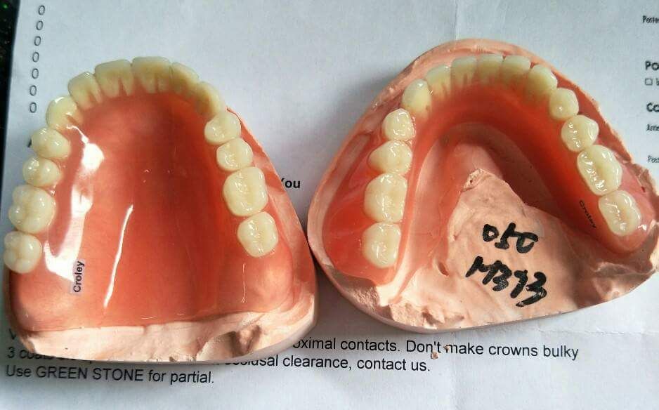 Dental acrylic denture removable denture flipper dental supplies
