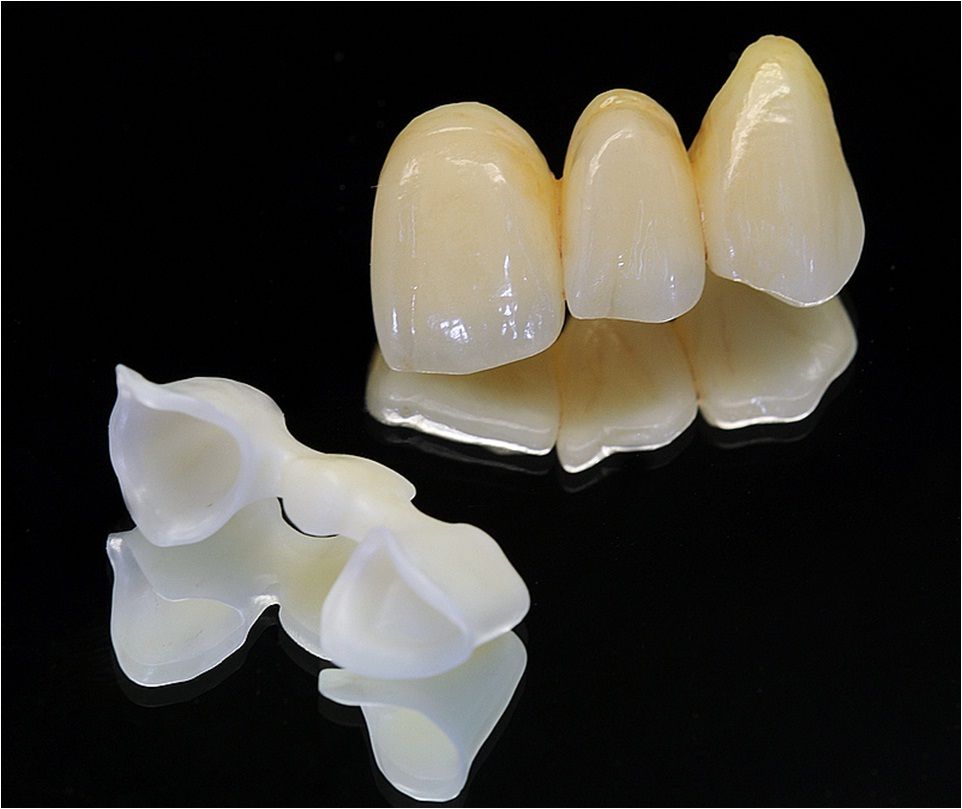 Dental All-Ceramic zirconia crown and bridge dental supplies