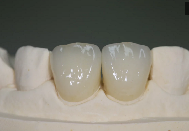 Dental All-Ceramic zirconia crown and bridge dental supplies