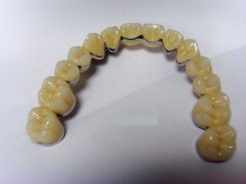 Dental pfm crown and bridge porcelain fused to metal crown dental supplies
