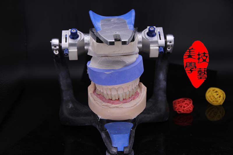 Dental implant zirconia crown and bridge dental supplies