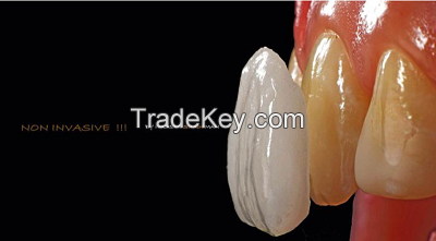 IPS Emax veneer, crown, inlay/onlay, dental supplies, dental survice