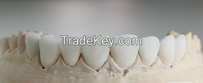 IPS Emax veneer, crown, inlay/onlay, dental supplies, dental survice