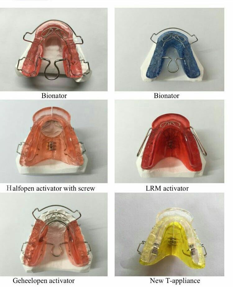 orthodonticappliance, dental supplies