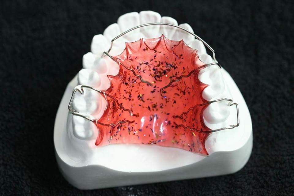 orthodonticappliance, dental supplies