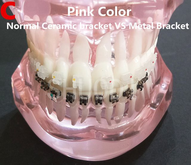 Dental Tooth Model Orthodontic Model for Patient Communication Dental Study