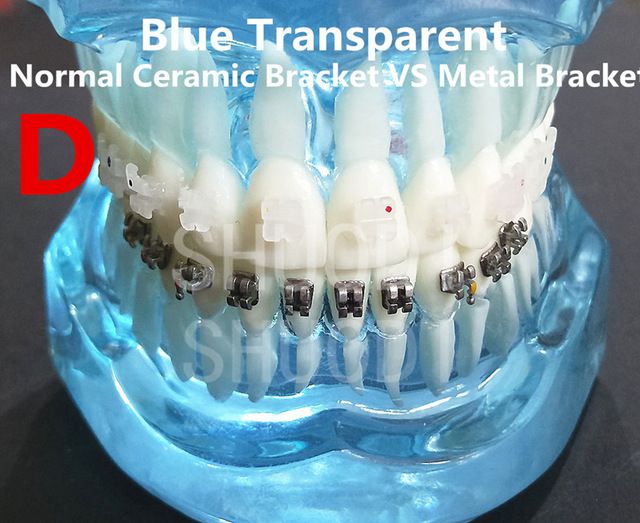 Dental Tooth Model Orthodontic Model for Patient Communication Dental Study