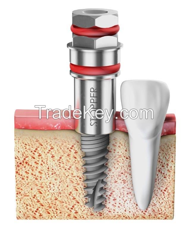 Atlas Dental Implants