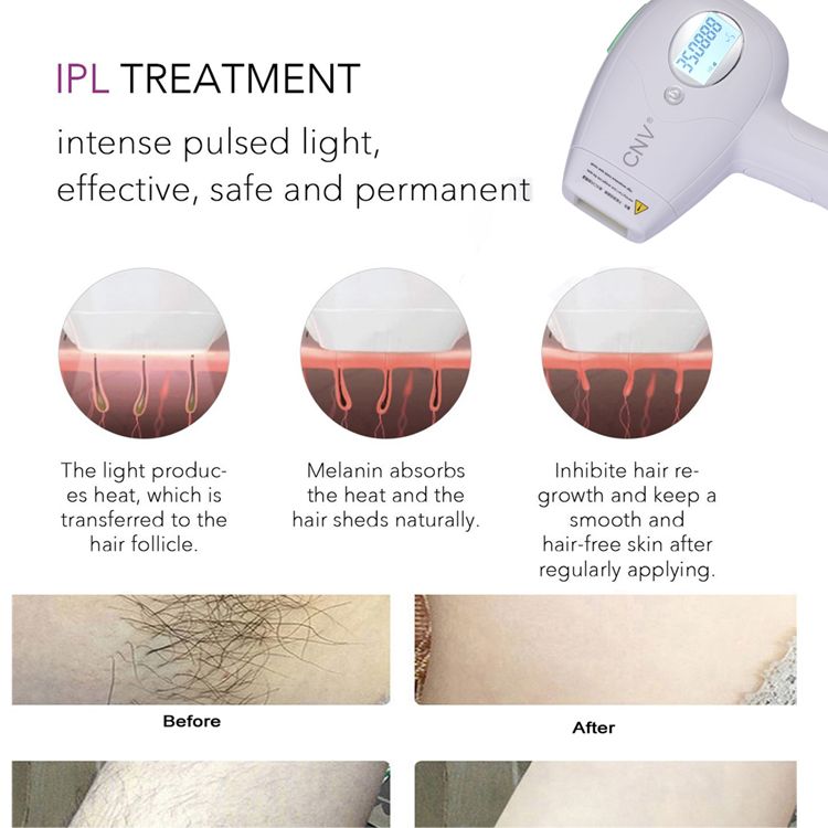 CNV Permanent Hair Removal WPL ICE Cool 350 000 Flashes Light