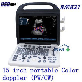 15 Inch Portable Color Doppler Ultrasound Scanner (pw/cw)