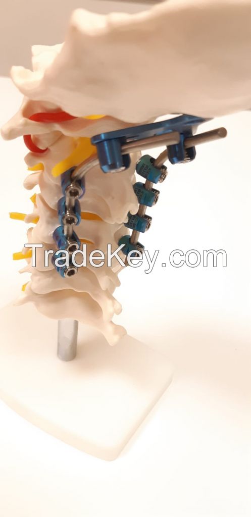 SPINE and TRAUMA IMPLANTS and INSTRUMENTS 