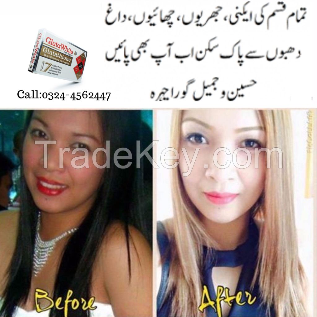 Best Skin Whitening Treatment with Creams, Injections, PILLS in Lahore, Islamabad, Karachi, Pakistan