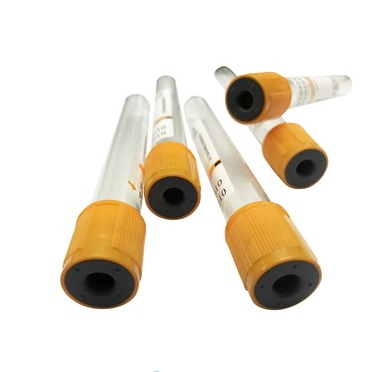 Quality assurance glucose tube vacuum tube plasma blood collection tube , blood sugar tube
