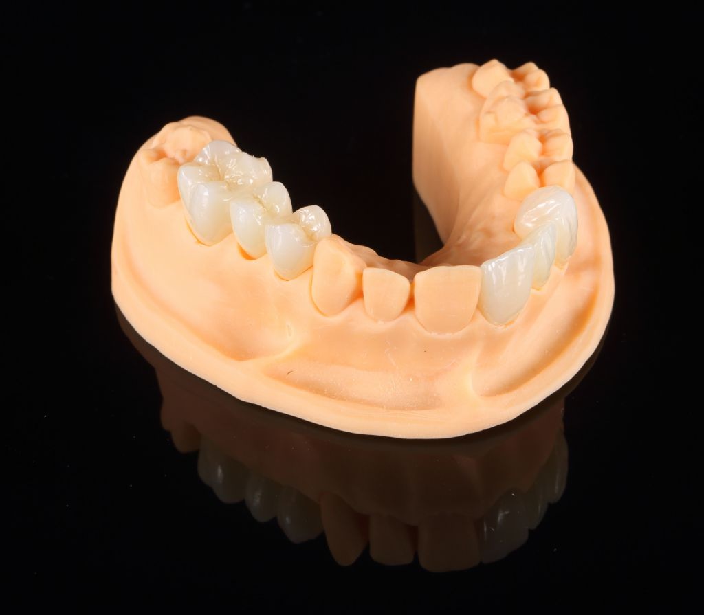 Yo Zirconia Smile Series Multilayer Dental Zirconia Ceramic Blocks for Full Crown, Inner Crown and Bridge