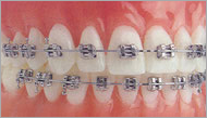 orthodontics, instruments, dental instruments