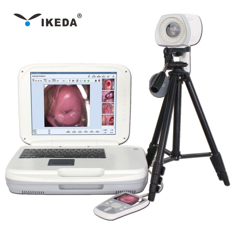 YKD-3004 Portable Digital Colposcope