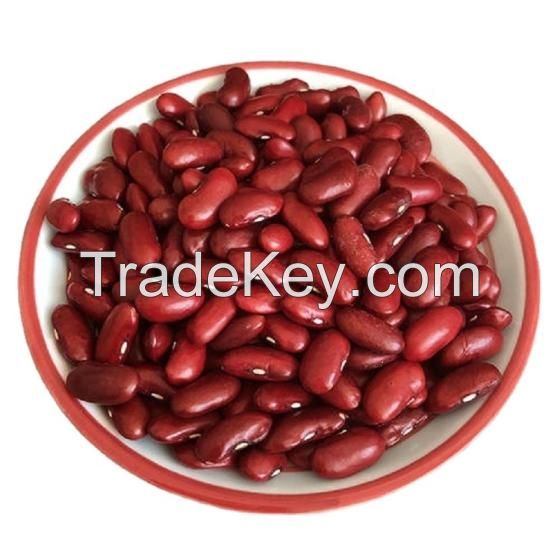 High Quality speckled light, Red, Black & White Kidney Beans