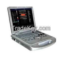 Laptop Medical Portable Ultrasound Scanner 4D Colour Doppler Ultrasound Machine