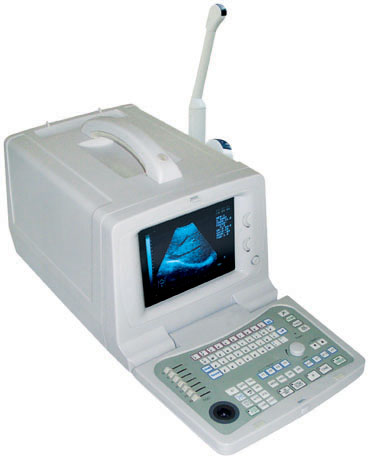 Ulteasound Scanner (SONEO800B)