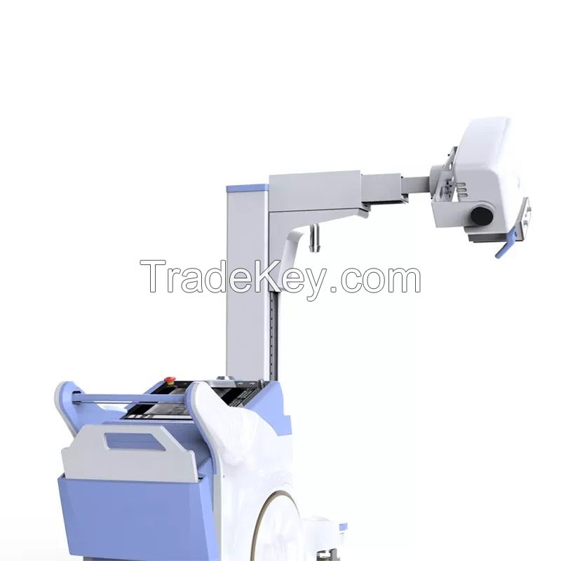 igh Frequency Digital Mobile Radiographic X-Ray Machine for Medical