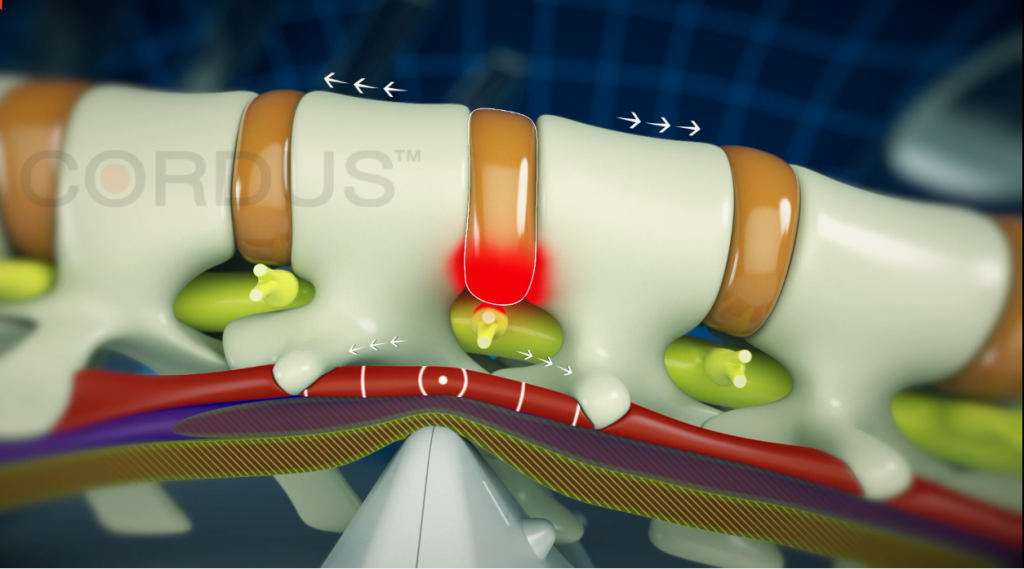 Device For Spine Relaxation, Apparatus For Spine Correction, Massager For The Neck, Back, Lumbar, Mechanical Back Simulator